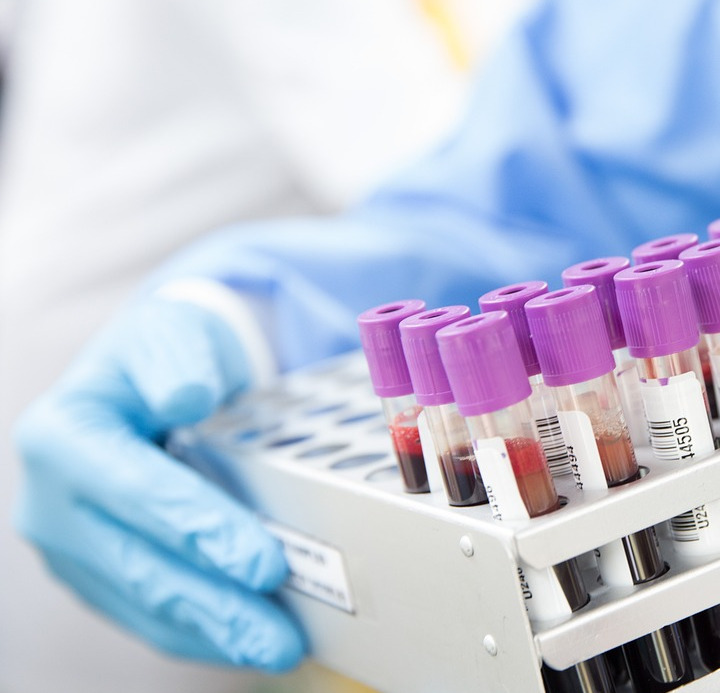 medical laboratory blood test